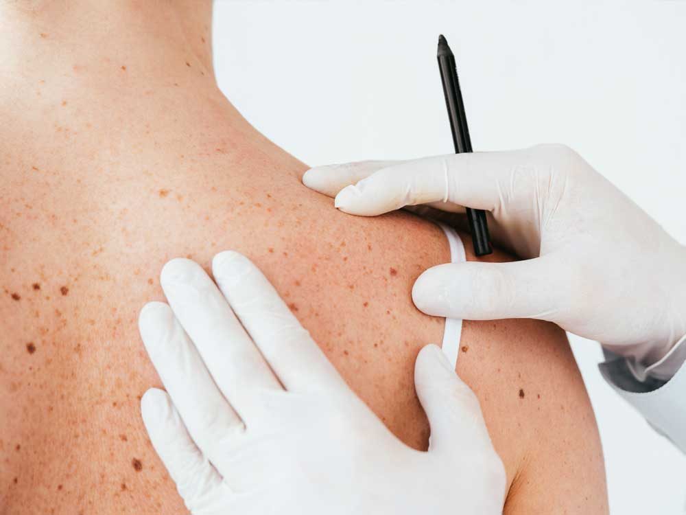 CONSULTA-DERMATOLOGICA